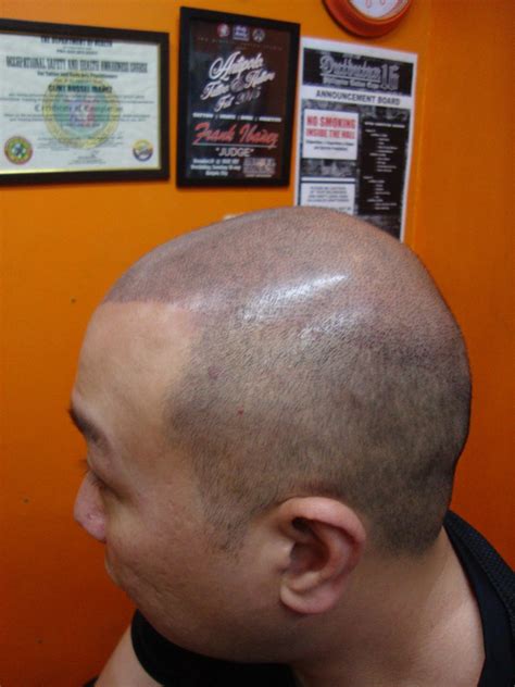 scalp tattoo manila philippines|Scalp Micropigmentation Manila, Philippines.